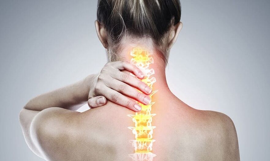 Οστεοχόνδρωση της αυχενικής μοίρας της σπονδυλικής στήλης